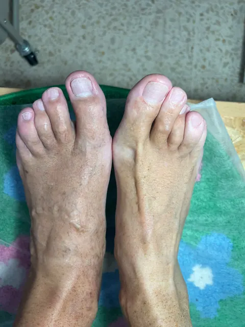 Pedicura realizada en AmOr